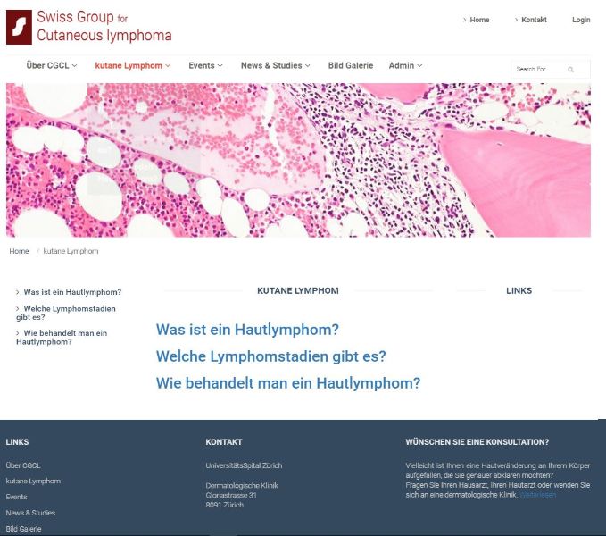 Swiss Group of Cutaneous Lymphoma (SGCL)